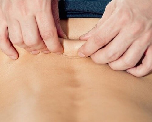 Myofascial Pain and Tendonitis in Low Back