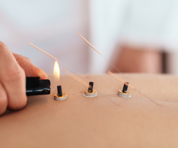 Acupuncture and Herbal Medicine
